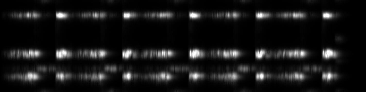 02 - Axial Focal